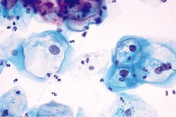 Diagnostic médical au microscope