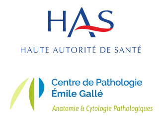 Dépistage du cancer du col de l’utérus